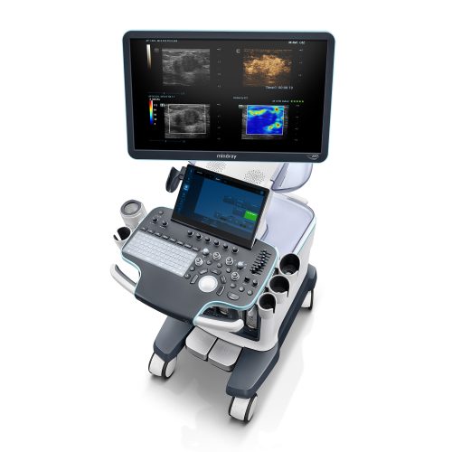 Ecograf Mindray Resona R9 - imagine 2