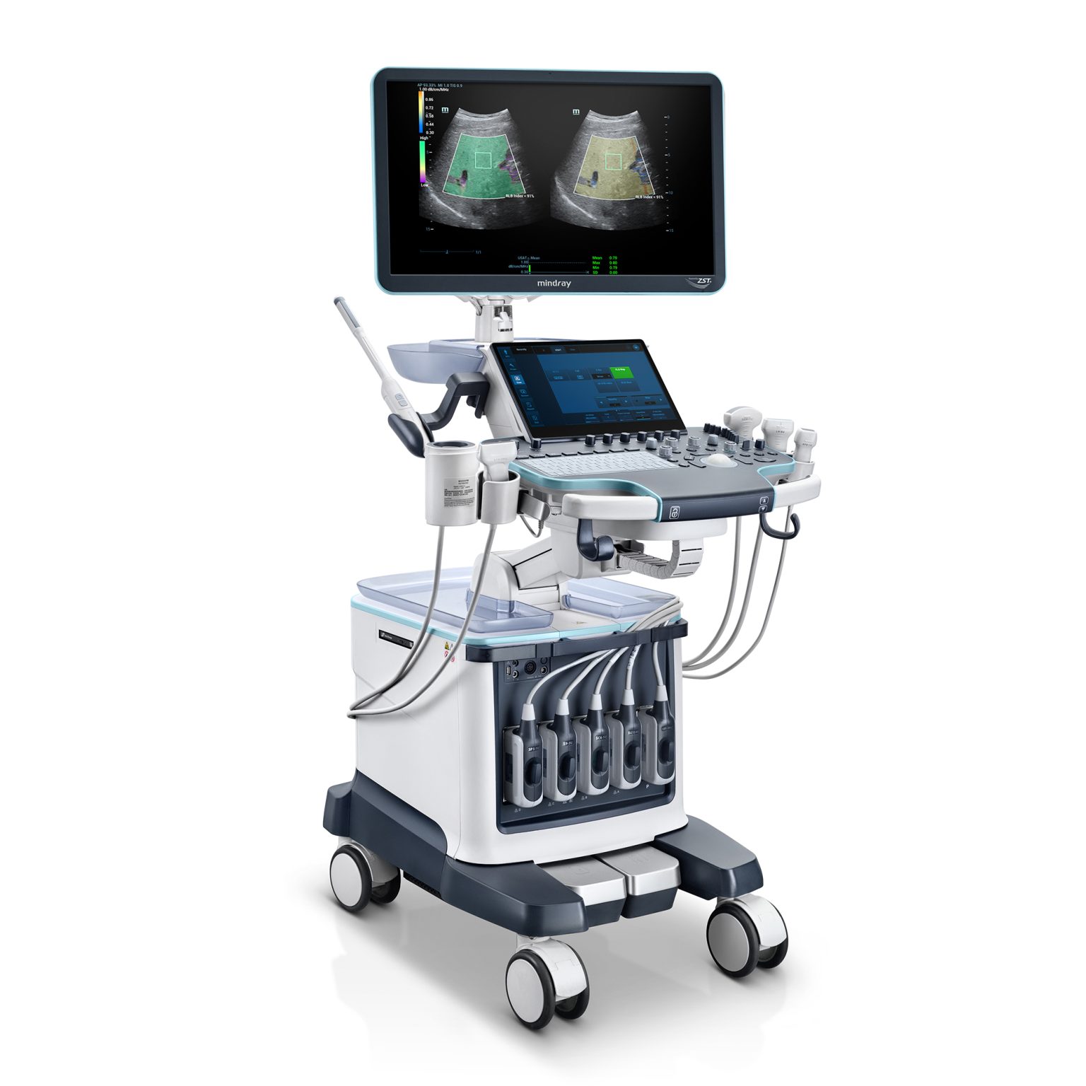 Ecograf Mindray Resona R9 » Ecografe pret avantajos | Ecografe Doppler ...